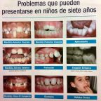 Problemas dentales en niños de 7 años