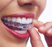 invisalign